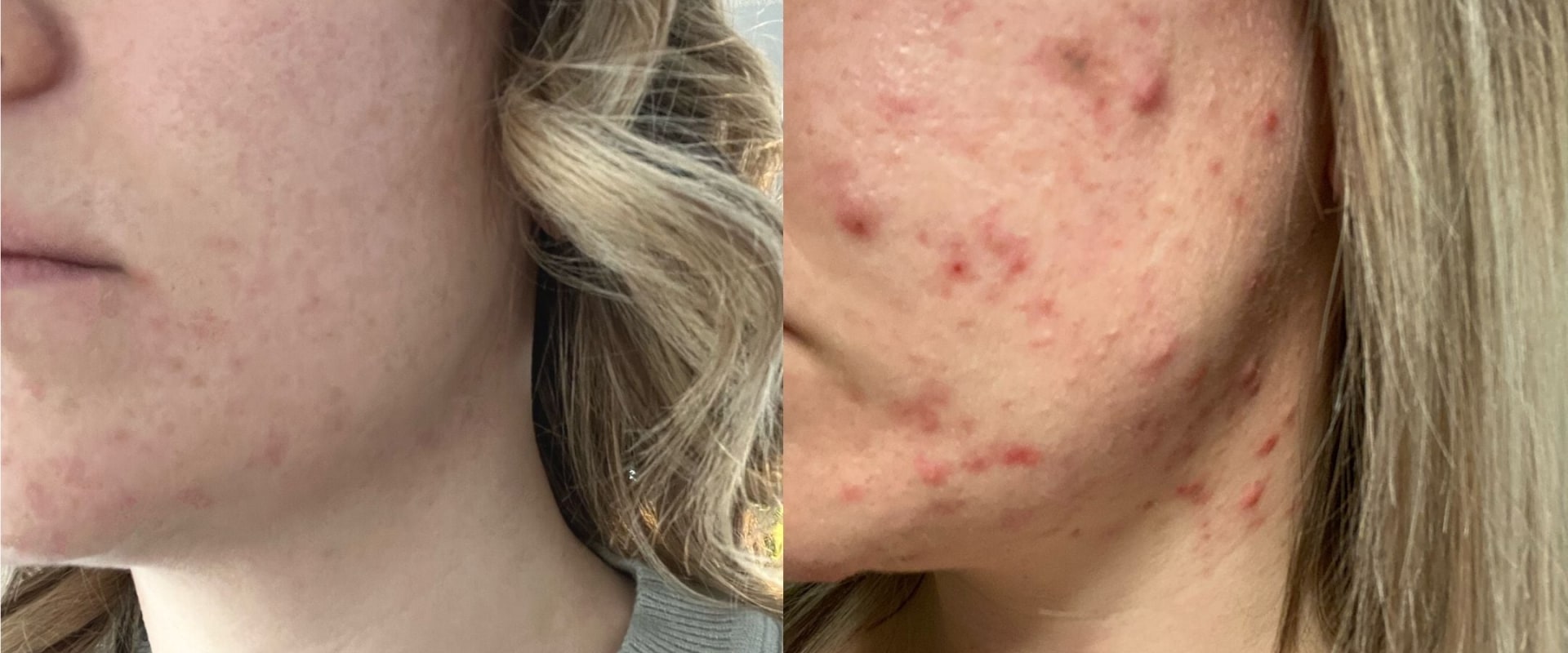 Before-and-after photos of various skin concerns